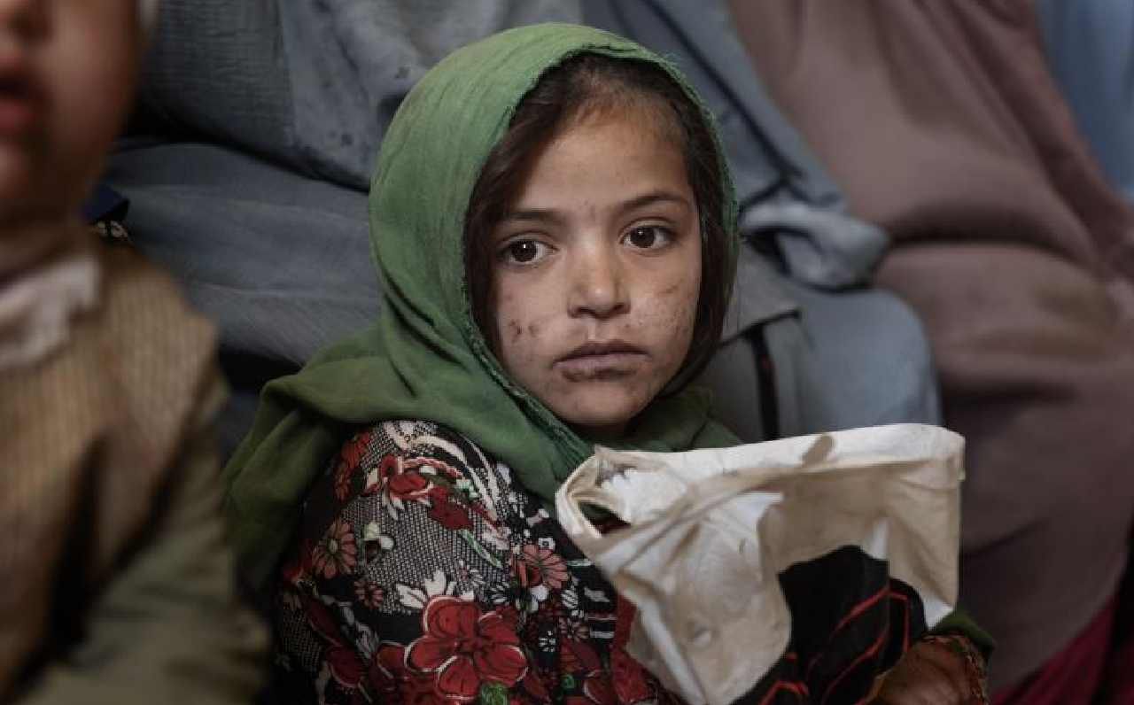 Problems of Afghan children in winter 2022