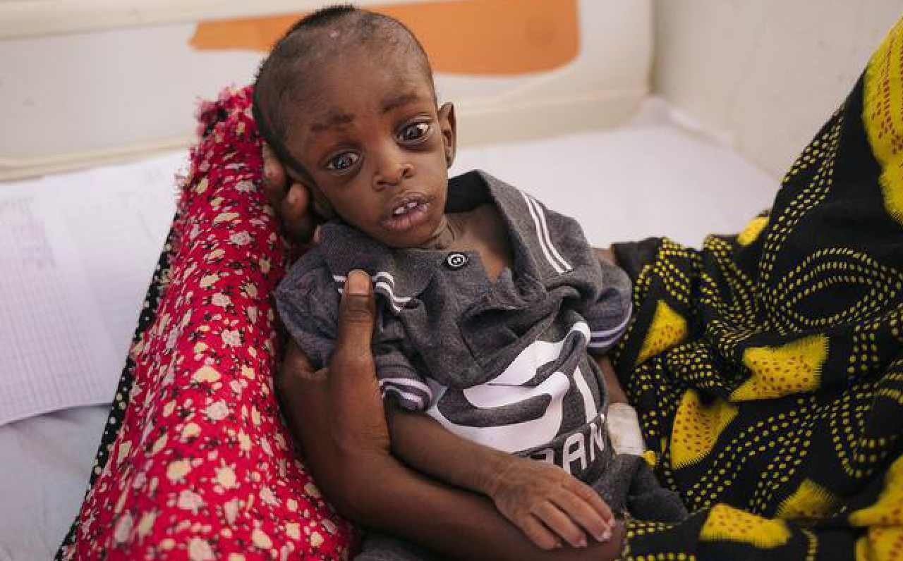 Horn of Africa: Millions of children are on the brink of death